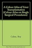 A colour atlas of liver transplantation