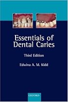 Essentials of Dental Caries: The disease and its management