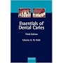Essentials of Dental Caries: The Disease and Its Management
