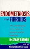 Endometriosis and Fibroids: The Complete Guide to the Causes, Symptoms and Treatments