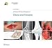 AO Manual of Fracture Management: Elbow & Forearm