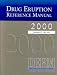 Search : Drug Eruption Reference Manual 2000, Millennium Edition DERM