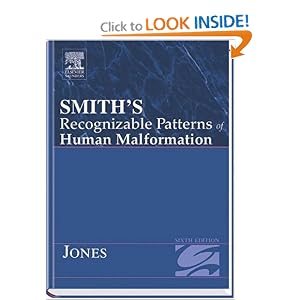 Click here to buy Smith's Recognizable Patterns Of Human Malformation Sixth Edition (Smith's... by Kenneth Jones.