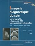 Imagerie diagnostique du sein : Mammographie, �chographie, IRM, techniques interventionnelles