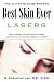 The Ultimate Guide for the Best Skin Ever: Lasers