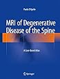 MRI of Degenerative Disease of the Spine: A Case-Based Atlas