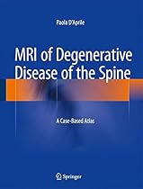 MRI of Degenerative Disease of the Spine: A Case-Based Atlas MRI of Degenerative Disease of the Spine: A Case-Based Atlas