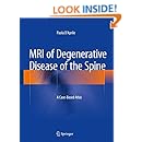 MRI of Degenerative Disease of the Spine: A Case-Based Atlas