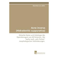 Acne inversa (Hidradenitis suppurativa): Klinische Daten und Histologie des Operationsguts von 60 Patienten. Die Suche nach ?sehr frühen? morphologischen Veränderungen. (German Edition)