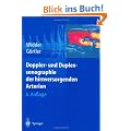 Doppler- und Duplexsonographie der hirnversorgenden Arterien