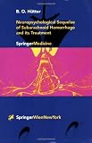 Neuropsychological Sequelae of Subarachnoid Hemorrhage and its Treatment