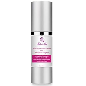 Amazon.com : Stretch Mark Cream for Pregnant Women, Mother's Select