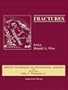 Fractures (CD-ROM for Windows & Macintosh)