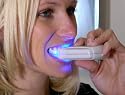 Viatek Hollywood Smiles Plasma Tooth Whitener