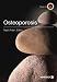 Book Osteoporosis (Illustrated)