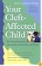 Your Cleft-Affected Child: The Complete Book of Information, Resources, and Hope