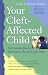 Book Your Cleft-Affected Child: The Complete Book of Information, Resources, and Hope