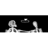 Xray rear window graphic