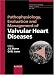 Search : Pathophysiology, Evaluation and Management of Valvular Heart Diseases, (Advances in Cardiology, Volume 39)
