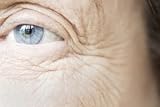 How To Get Rid of Crows Feet 41RA00SiwWL. SL160 How To Get Rid of Crows Feet