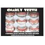 Gnarly Teeth fake dentures as seen on the tv show Outsourced