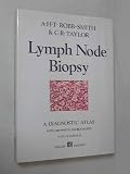 Lymph node biopsy