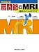 肩関節のMRI−読影ポイントのすべて 肩関節のMRI−読影ポイントのすべて