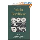 Valvular Heart Disease (Fundamental and Clinical Cardiology) by Al-Zaibag