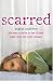 Scarred  She Was a Slave to Her Father, Pain Was Her Only Escape