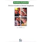 Dentistry Explained: A Patient Guide to Dental Implants by  Baer