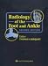 Radiology of the Foot and Ankle
