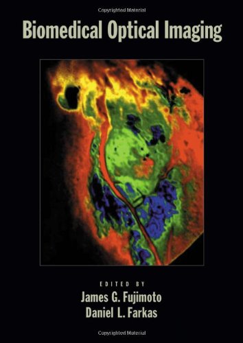 biomedical optical imaging