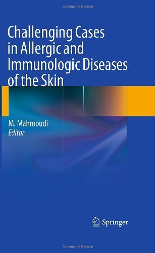 Challenging Cases in Allergic and Immunologic Diseases of the Skin by Springer (2010-09-13)