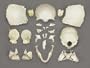 Disarticulated Female Skull Model in Storage Box