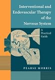 Interventional and Endovascular Therapy of the Nervous System: A Practical Guide
