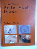 A colour atlas of peripheral vascular diseases