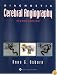 Diagnostic Cerebral Angiography