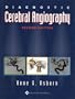 Diagnostic Cerebral Angiography