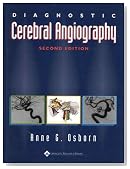 Diagnostic Cerebral Angiography