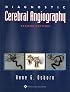 Diagnostic Cerebral Angiography