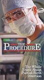 The Procedure [VHS]