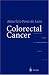Colorectal Cancer