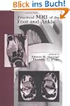 Practical MRI of the Foot and Ankle
