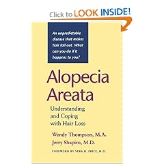 Alopecia Areata: Understanding and Coping with Hair Loss