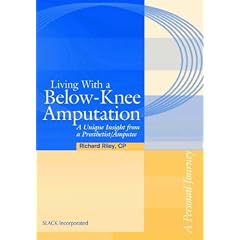 Living with a Below-Knee Amputation: A Unique Insight from a Prosthetist/Amputee
