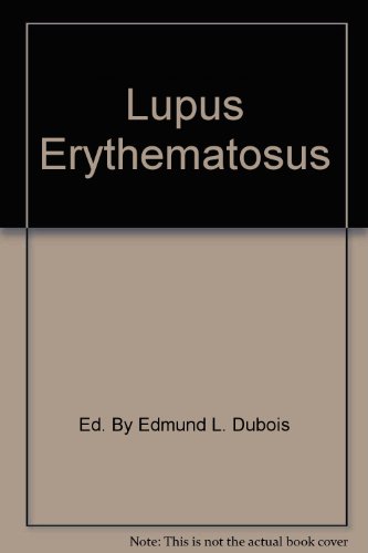 lupus erythematosus  a review of the current status of discoid and systemic lupus erythematosus and their variants