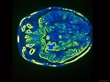 Computer Aided Tomography Imaging Plane Brain Ct Photographic Poster Print, 16x12