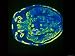 Computer Aided Tomography Imaging Plane Brain Ct Photographic Poster Print, 16x12