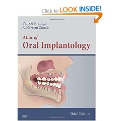 Atlas of Oral Implantology,