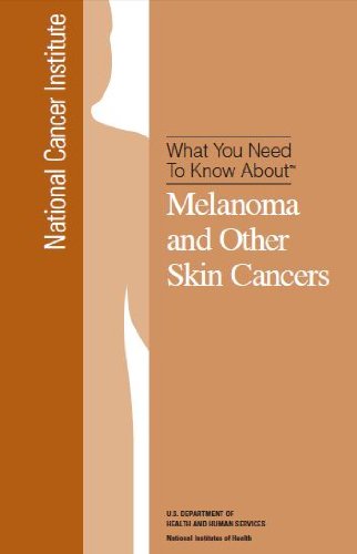 skin cancer